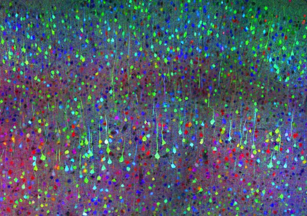 faisceaux multicolores représentant les connexions cérébrales
